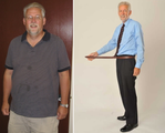 Gastric Bypass