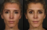 Restylane, Sculptra, Dysport, Obagi Professional C Serum, Cosmelan, Latisse