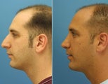 Facial plastic surgery