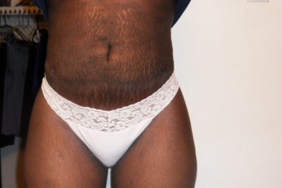 ANSWERED: Why does my stomach feel so.