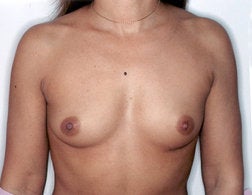 34c breast size. Full size - 34C bra size 325cc