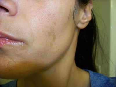 Get The #1 Rated HCG Diet Drops In.