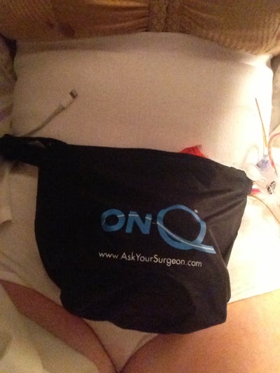Hydromorphone vs Oxycodone - Hip Forums
