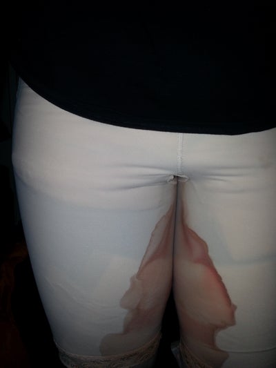 Laser Liposuction Reviews || Cheap.