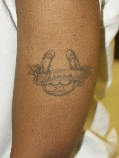 tattoo removal before after. Back to Tattoo Removal Gallery