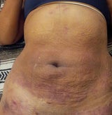 babyfat gone,love new body