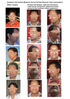 todearbobby