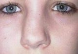 nikki93