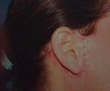 UGLYSCARS