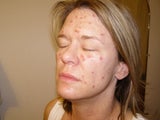 Lisa Hagner