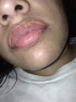 Does this look normal ? I got it done 3 days ago 
