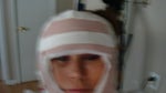 after surgery,not much disconfort