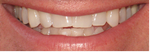 Before any treatment