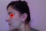 Should I get primary rhinoplasty?