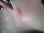 scar from whatever they messed up still don't know how this happened