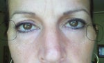 Uneven puckers, very embarrassing!!!! 