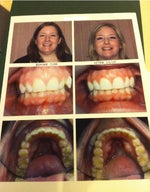 The finished product! Before and after, side-by-side.
