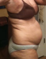 Side view before