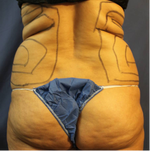 Back Pre