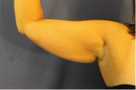 R arm pre