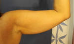 r arm back