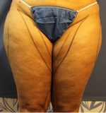 Thighs front pre