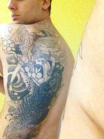 Tattoo removal options for a Mid-back tattoo