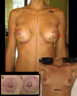 R areola almost a perfect circle (very fake) and L looks like a flower?