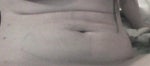 My stomach hangs the exact same way as it used to. Its even evident when im wearing my compression garment (which i only took off to take these pics) My stomach hangs the exact same way as it used to. Its even evident when im wearing my compression garment (which i only took off to take these pics)