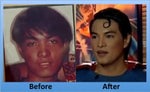 Plastic Surgery to Look Like Superman