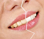 5 Ways to Get Whiter Teeth (from a Girl Who's Tried Everything)