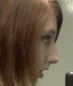 How can i get my parents to let me get Rhinoplasty?