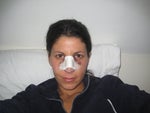 So here it is... me, the day after surgery. I get a lot of questions about the cast, bruising, going out in public etc. Decide for yourself! lol. Needless to say, I chose NOT to go out of the house :)