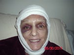 just had surgery yesterday...here is my glamour shot, lol....pain not as intense as i had imagined it to be