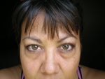 Before. No make up in natural lighting.