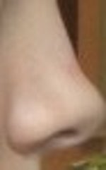 What to do with upturned nose?