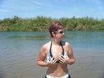 This is me over a year after surgery!