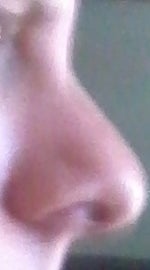 I really want to get rhinoplasty but not sure how to let my parents know or if i should even bother, guy, 21