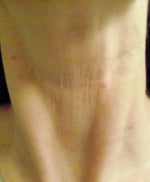 Is there a non-invasive procedure/product to tighten my neck?