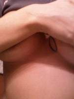 Painful bump after submuscular breast augmentation