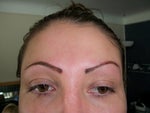 Removing permenant makeup eyebrows