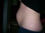 Mini tummy tuck vs. full tummy tuck