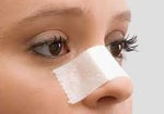 What are the "proper" expectations of your Rhinoplasty?