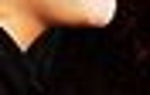 Is there a non surgical option for the beginnings of a "turkey neck?"