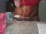 worried day 5 post-op