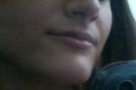 Unsatisfied with Juvederm results- injected into my lips?