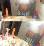 tummy tuck after baby