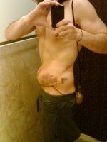 kind of freaking out. need advice from TT vets, bruising and swelling w/ pic