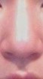 I would like to make my nose smaller overall