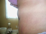 Folds at each end of my incision.